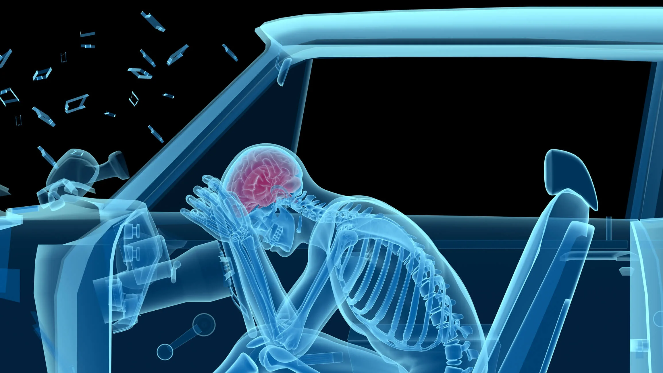 X-ray of a man in a car accident